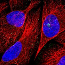 SNX21 Antibody, Novus Biologicals 0.1mL; Unlabeled:Antibodies, Polyclonal
